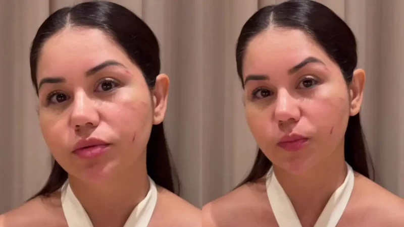 Esposa de Diego, da dupla com Victor Hugo, denuncia agressão (Foto: Reprodução Redes Sociais)