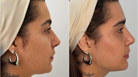 Lauana Prado: Transformação e a Polêmica da Beleza Natural