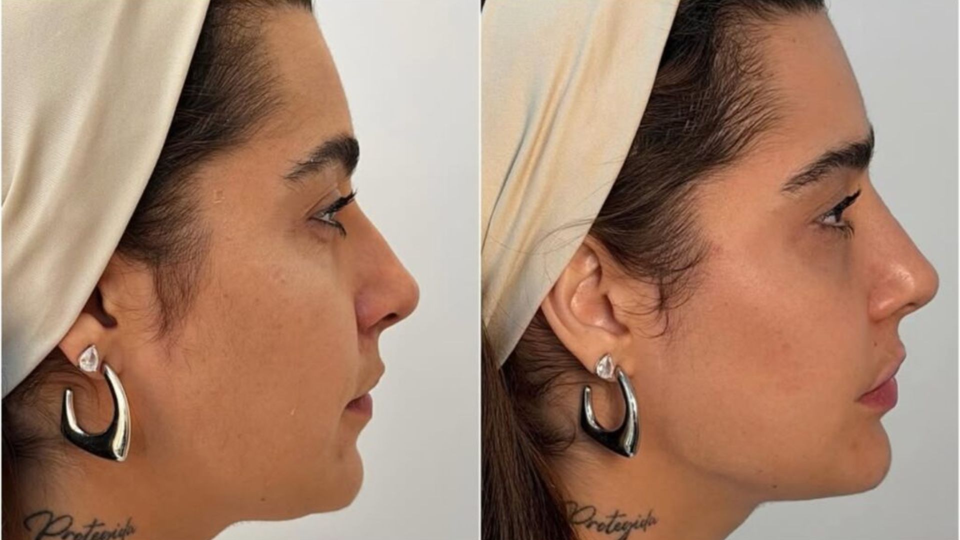 Lauana Prado: Transformação e a Polêmica da Beleza Natural