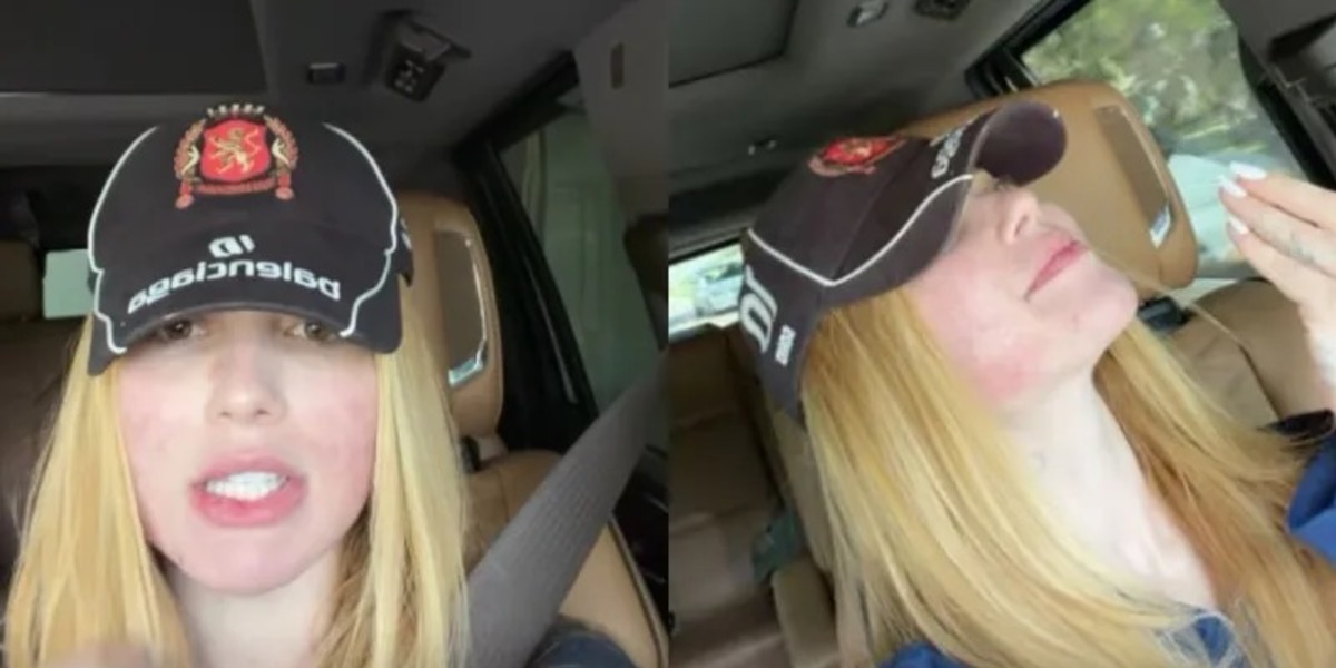 Virginia desabafa sobre tratamento que deixou seu rosto arrasado Virginia desabafa sobre tratamento que deixou seu rosto arrasado