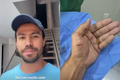 Mariano, da dupla Munhoz, se acidenta e leva pontos na mão