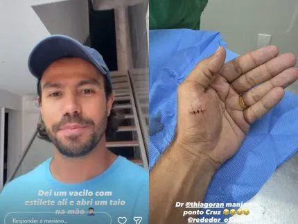 Mariano, da dupla Munhoz, se acidenta e leva pontos na mão