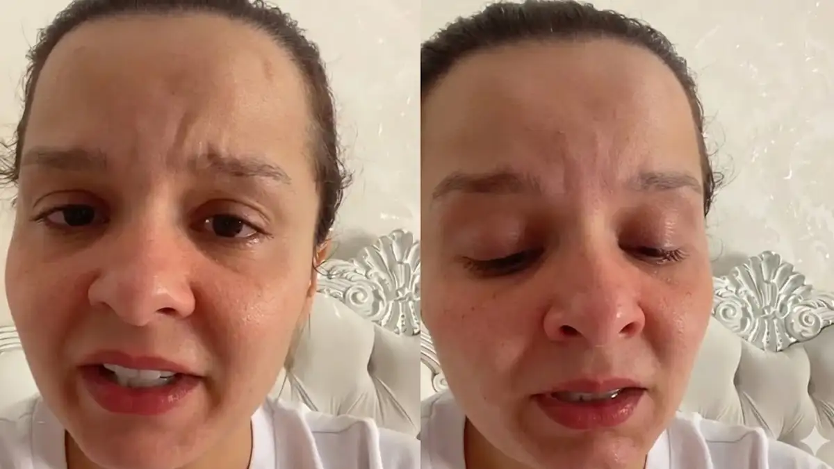 A cantora sertaneja enfrenta queda de cabelo, baixa autoestima e segue em tratamento em 2026.(Foto: Reprodução Redes Sociais)